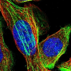 TMEM17 Antibody, Novus Biologicals 0.1 mL | Buy Online | Novus Biologicals | Fisher Scientific